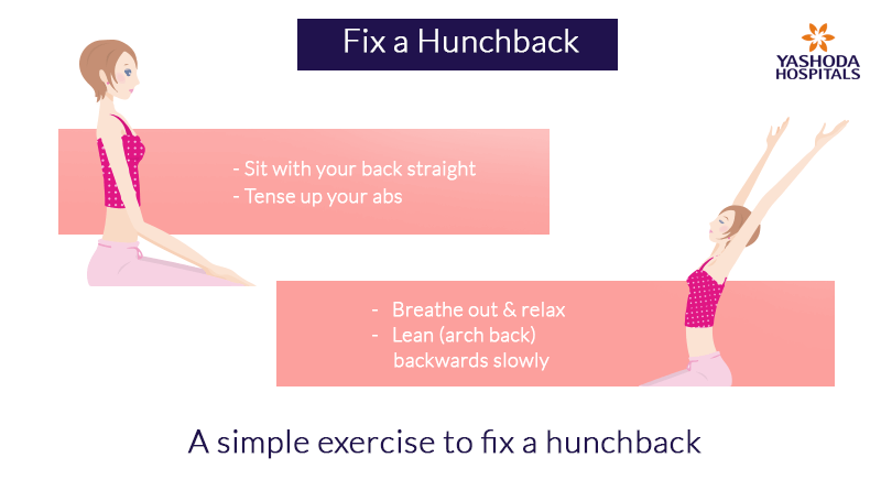 A simple exercise to fix a hunchback