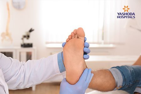 Adult Acquired Flatfoot: Diagnosis, Prevention and Treatment