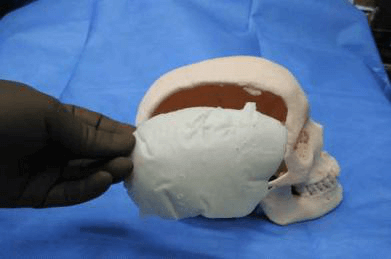3d printing in healthcare