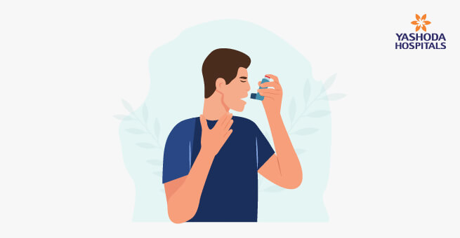 Asthma Causes, Symptoms & Treatment2