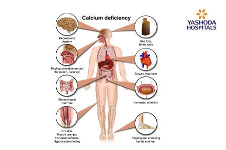 Calcium metabolism disorders: Symptoms and Complications