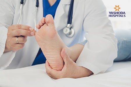 Claw Toe: Diagnosis, Prevention and Treatment