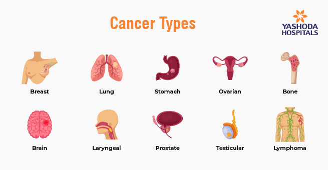 Demystifying The Complexities Of Cancer A Comprehensive Awareness Guide_Body 2