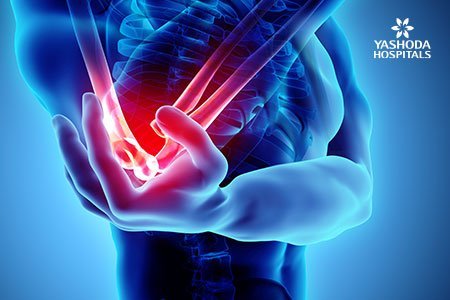 Elbow Instability: Symptoms, Risk Factors and Complications