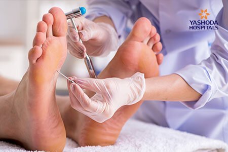 Hammer Toes Diagnosis Prevention and Treatment