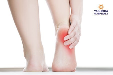 Heel Pain: What is Hammer Toes, its Causes?