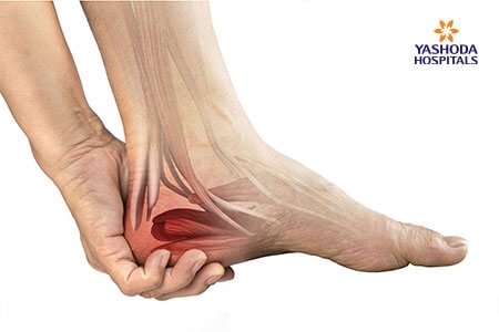 Heel Pain: Symptoms and Complications