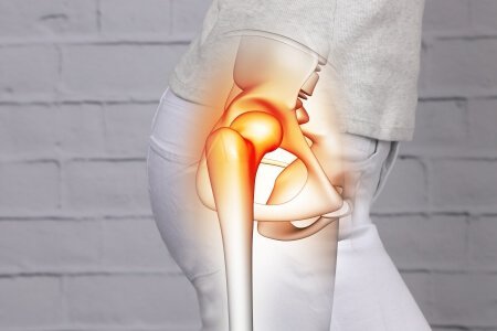 Hip Osteonecrosis: What is Hip Osteonecrosis, its Causes