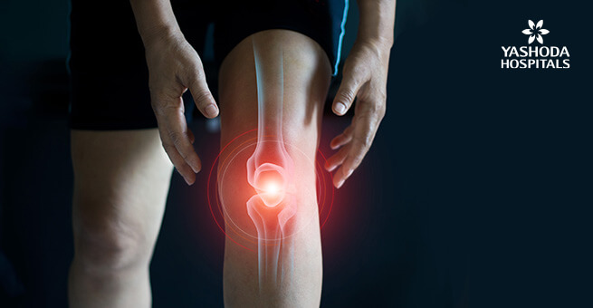 If your joints hurt, it is arthritis