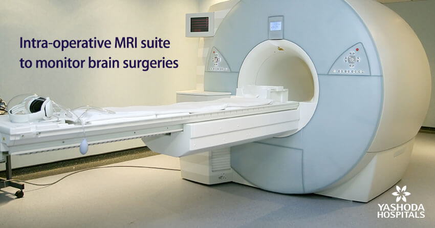 Intra-operative MRI suite to monitor brain surgeries