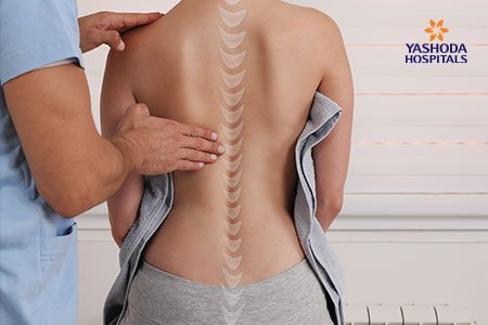 Kyphosis of the Spine diagnosis