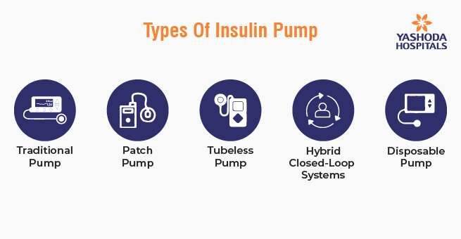 Managing Diabetes with Insulin Pumps