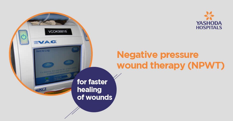 Negative pressure wound therapy (NPWT)