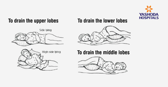 Positions to help keep your chest clear