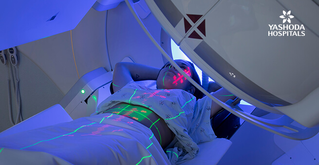 Radiation therapy treatments