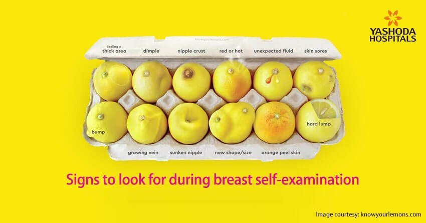 Signs to look for during breast self-examination