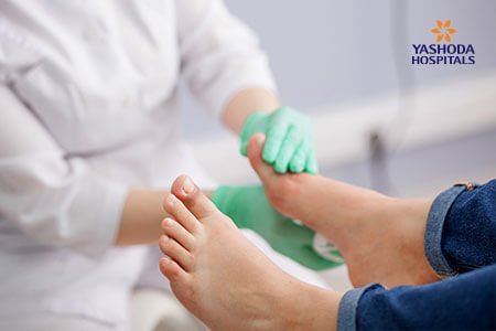 Stiff Big Toe (Hallux Rigidus): Diagnosis, Prevention and Treatment