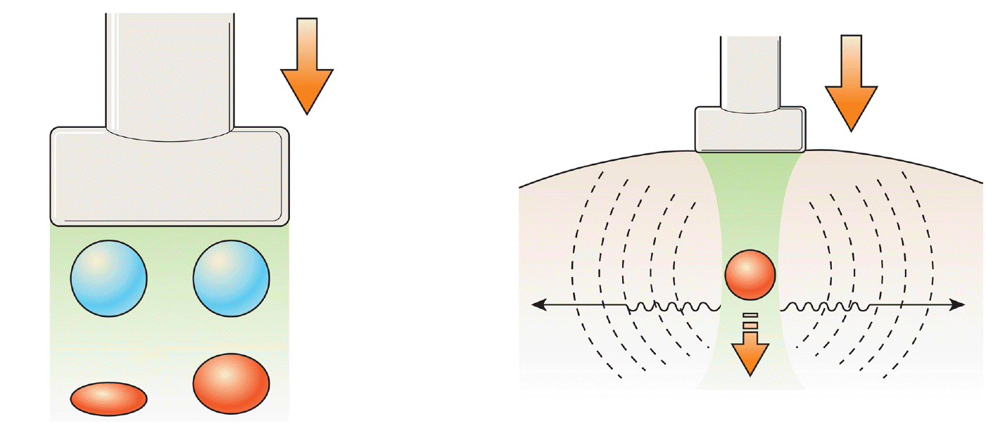 Strain Elastography (left) vs Shear Wave Elastography (right)