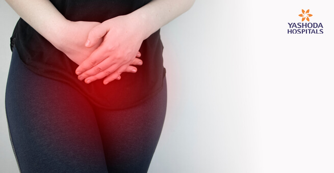 symptoms of Uterine Fibroids