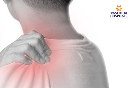 Thoracic Outlet Syndrome: What are the Symptoms, Risk Factors and Complications