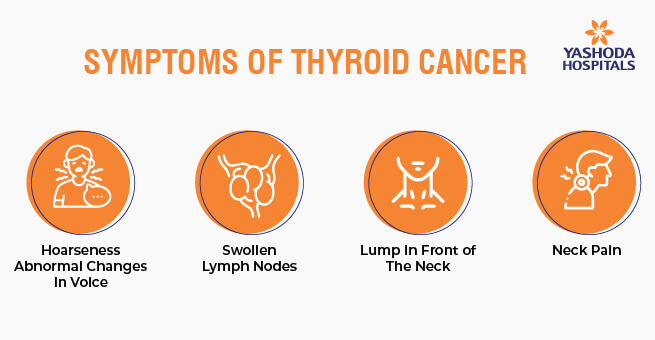 Thyroid Cancer Insights into the Butterfly Gland's Battle_Body 2