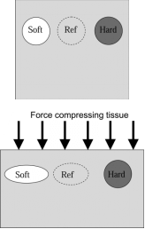 To an external compressive force, a soft lesion is more deformable, whereas, a hard lesion is less deformable relative to the surrounding tissue