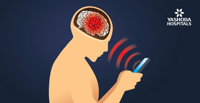 Usage of mobile phones can lead to a brain tumor