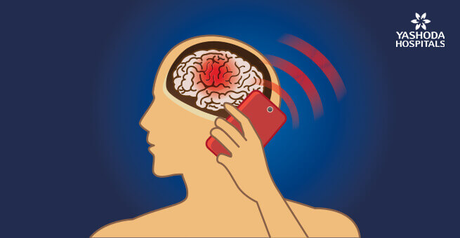 brain damage using mobile phone radiation