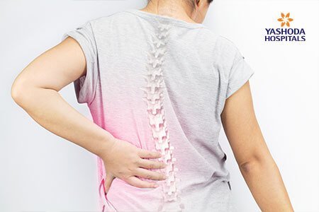 causes of Scoliosis