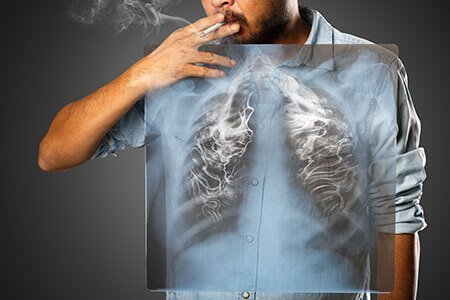 causes of lung cancer