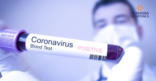 corona virus test