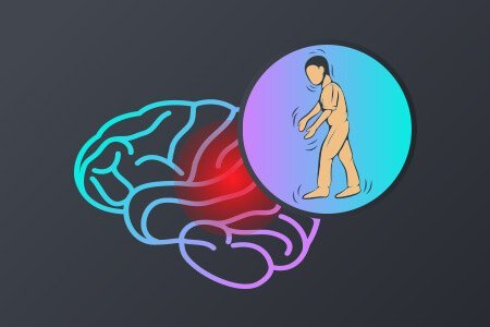 deep brain stimulation for parkinson’s disease