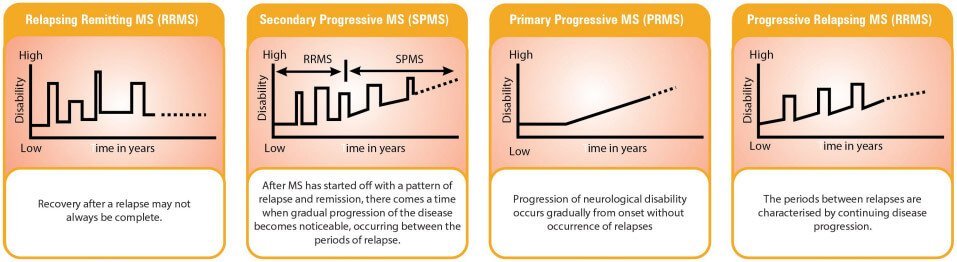 symptoms and course of MS can vary considerably from person to person