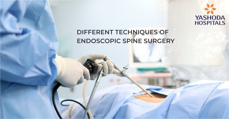 minimally invasive spine surgery - endoscopic spine surgery