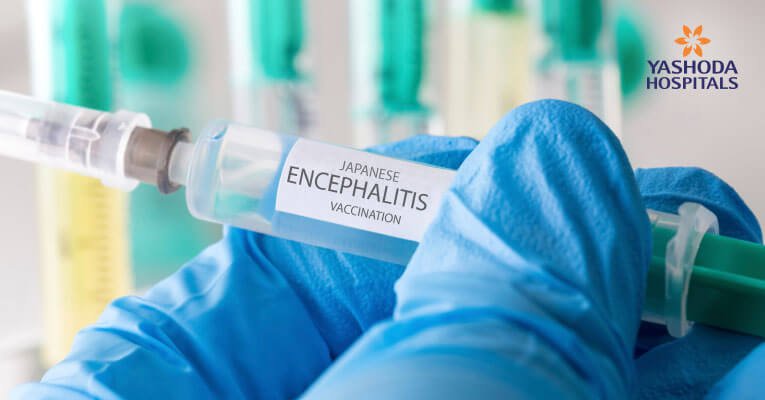 Encephalitis-brain fever outbreak