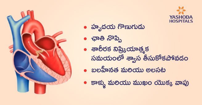 rheumatic heart disease symptoms 