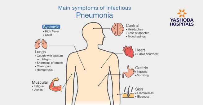 signs and symptoms of pneumonia