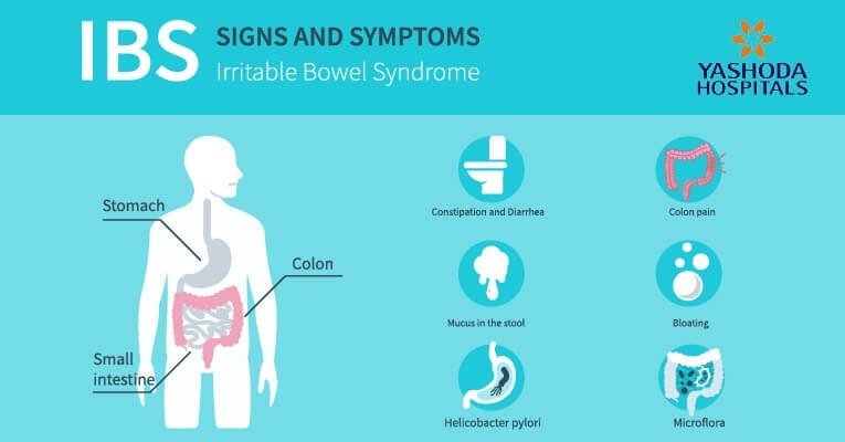 symptoms of Irritable bowel syndrome