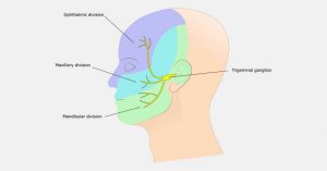 What is Trigeminal Neuralgia