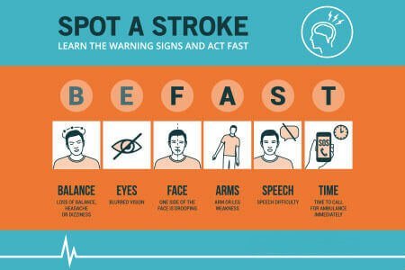 symptoms of brain stroke