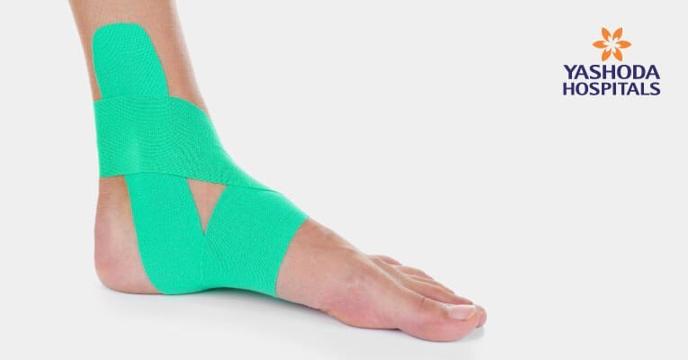treating heel pain