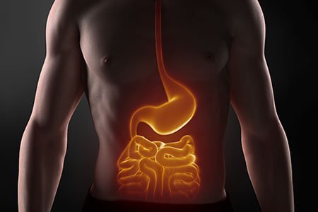 inflammatory bowel disease or chrohns disease