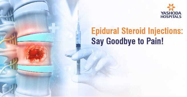 Epidural Steroid Injections : Say Goodbye to Pain!