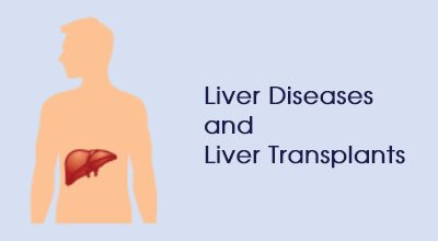 Liver dieases liver transplants Infographics