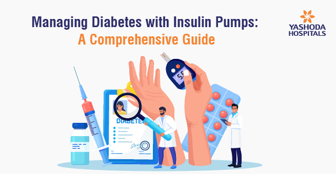 Managing Diabetes with Insulin Pumps: A Comprehensive Guide