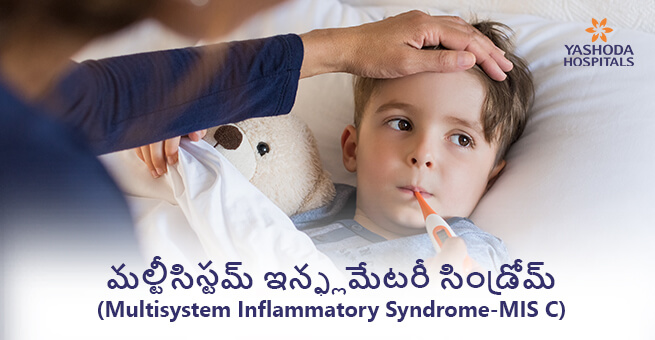 Multisystem inflammatory syndrome-MIS C