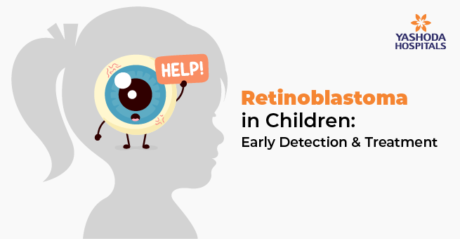 Retinoblastoma in Children: Early Detection and Treatment