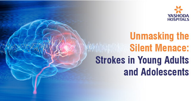 Decoding Strokes in Youth: Prevalence, Symptoms, and Prevention