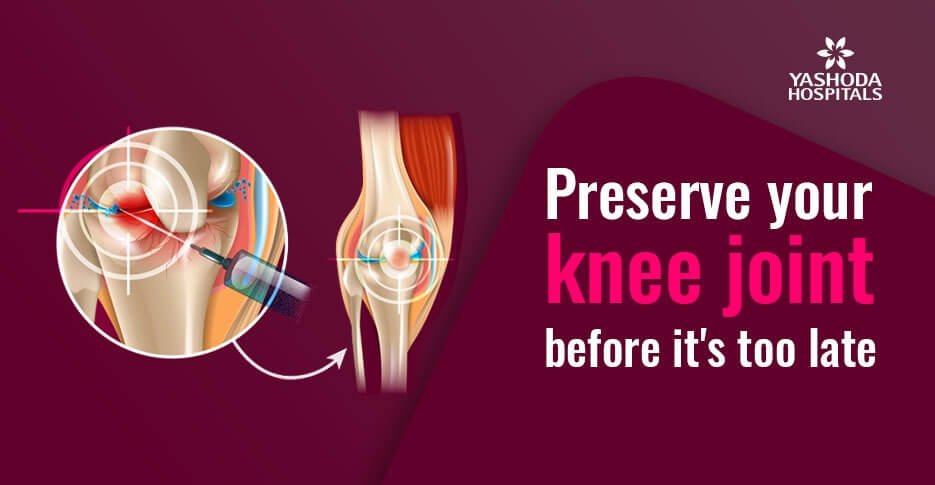 preserve your knee joint before its too late